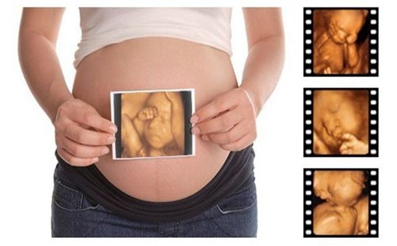 孕妇超声检查怎么怎么选？